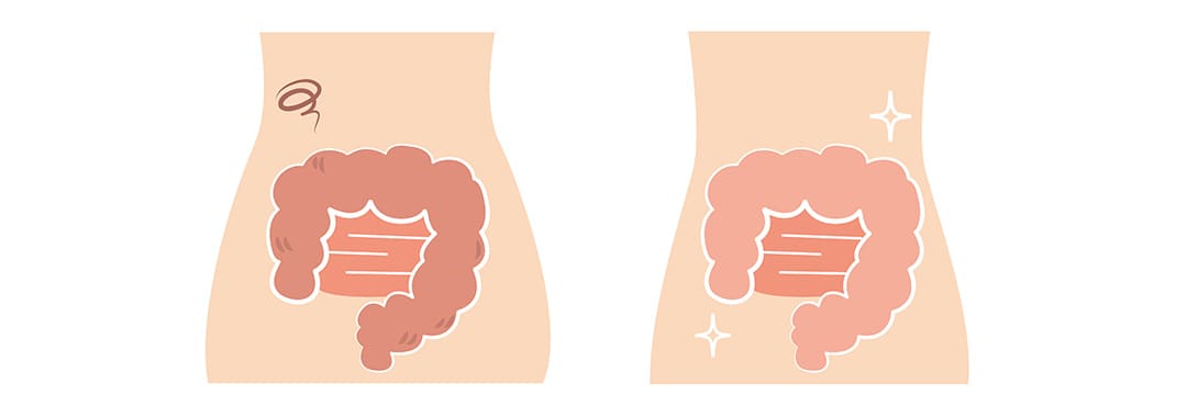 腸活でお腹を緩めるのがポイント！